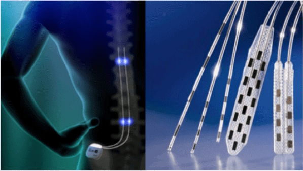 Medical images of the spine